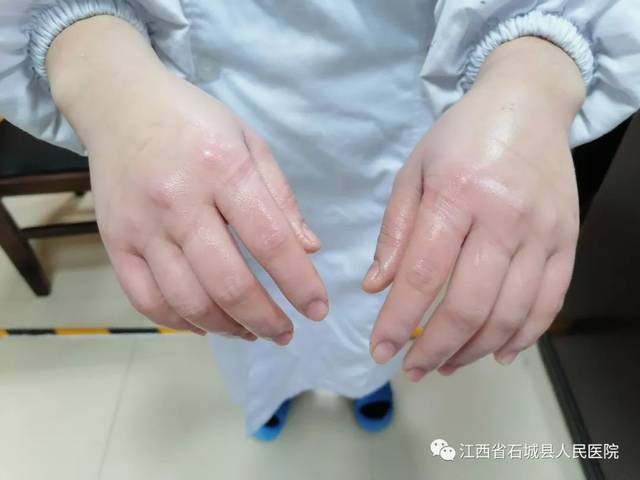 【媒体聚焦】 致敬!最美的白衣天使