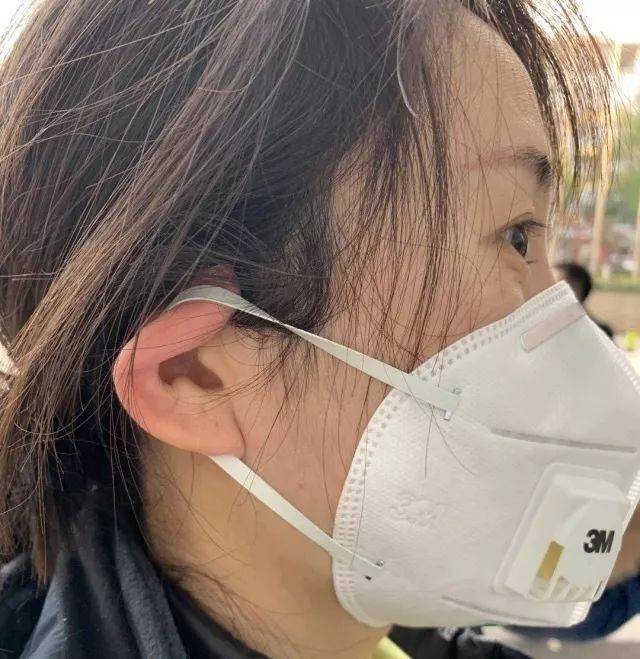 脱下防护服医护人员满脸压痕同仁医院制定口罩压痕防治方案