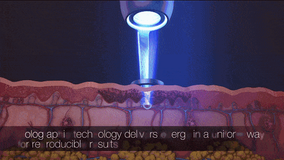 不同的皮肤层次 发挥嫩肤亮白,促进胶原蛋白新生等作用 3 更强光斑