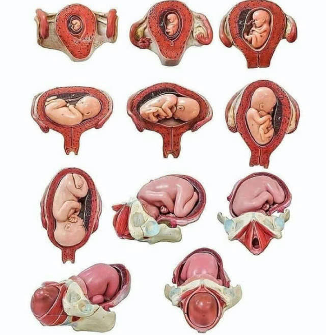 若胎儿为"臀位",医生会给出"纠正胎位"的建议,看到临近分娩的时候,能