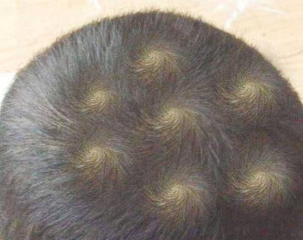 宝宝头上的"旋"代表什么?命运还是性格?现在知道还不晚