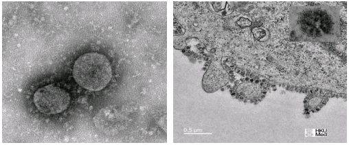 新型冠状病毒的电镜图(图片引自网络).