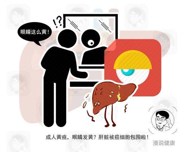 原创 肝脏癌变不痛不痒?提醒:6个不适再容忍,肝病最终只能走向肝癌