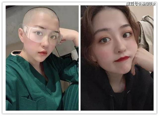原来你那么美:剃光头的洛阳95后姑娘王亚娟从武汉发来视频.
