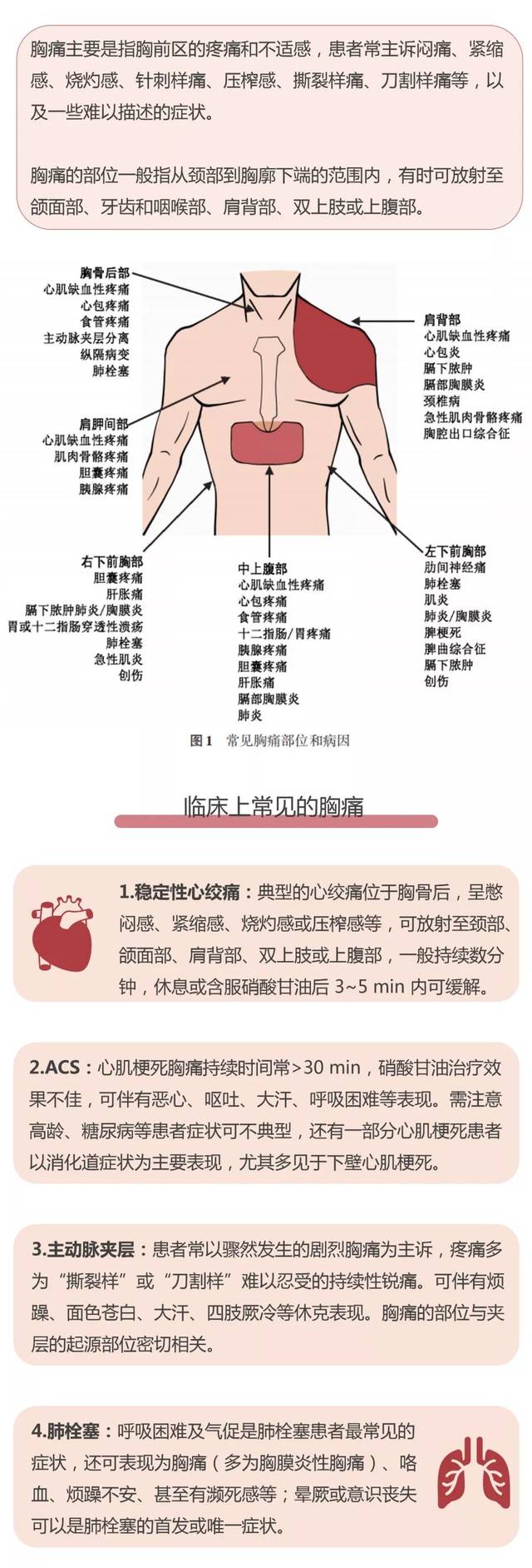 心口疼不一定是心脏病!一图读懂胸痛的12种原因