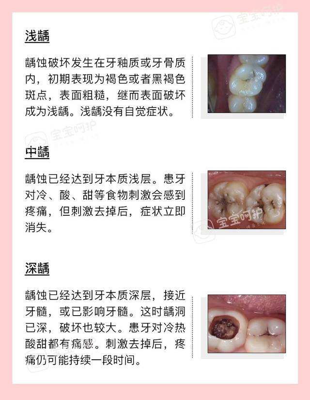 9% 换句话说,10个孩子中,就有7