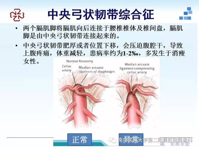 膈肌的解剖及常见病变影像表现