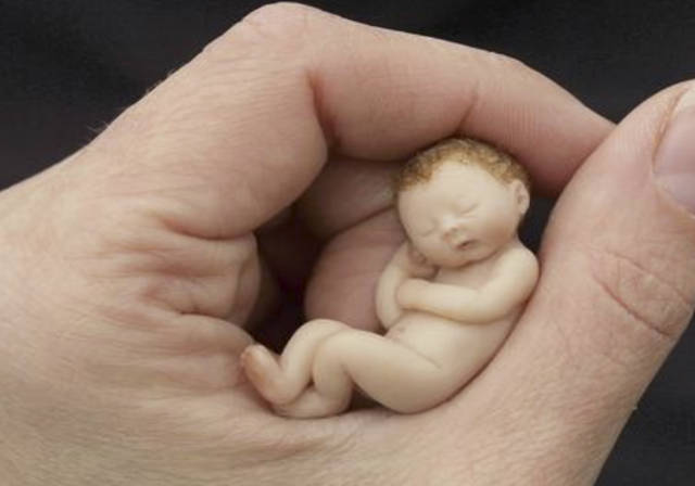 原创世上最小的早产儿仅半斤重,"拇指宝宝"成功存活,医生:是奇迹