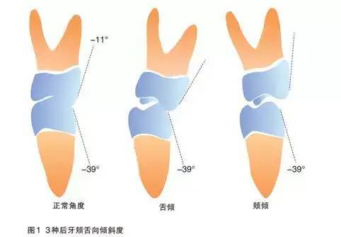 你的咬合关系正常吗?不如来个自测