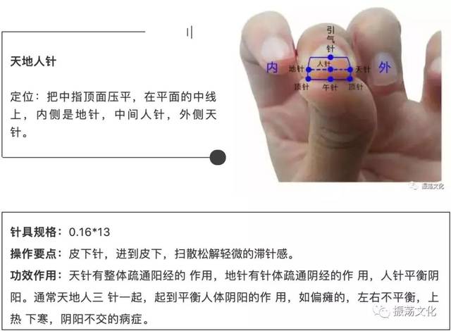 气血疏通高级针法简解——李正坤_手机搜狐网