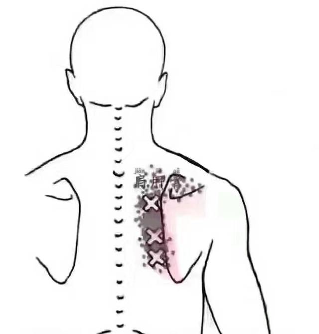 肩胛骨位于背部的外上方,在体表可触及. 肩胛缝是乳腺的反射区.