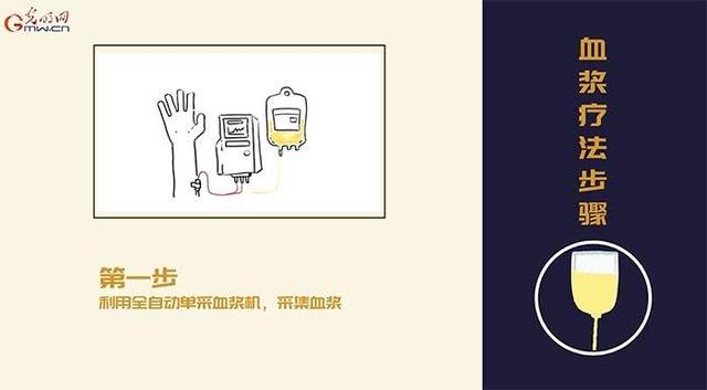 第一步,利用全自动单采血浆机,采集血浆