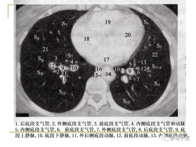 肺段与肺内管道应用解剖