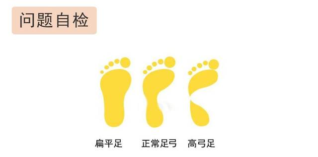 如何判断孩子有没有扁平足,内八字,足外翻,xo型腿等各类问题?