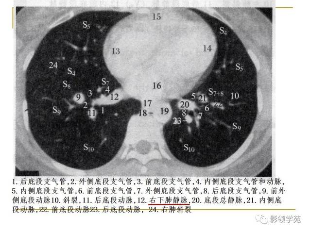 肺段与肺内管道应用解剖