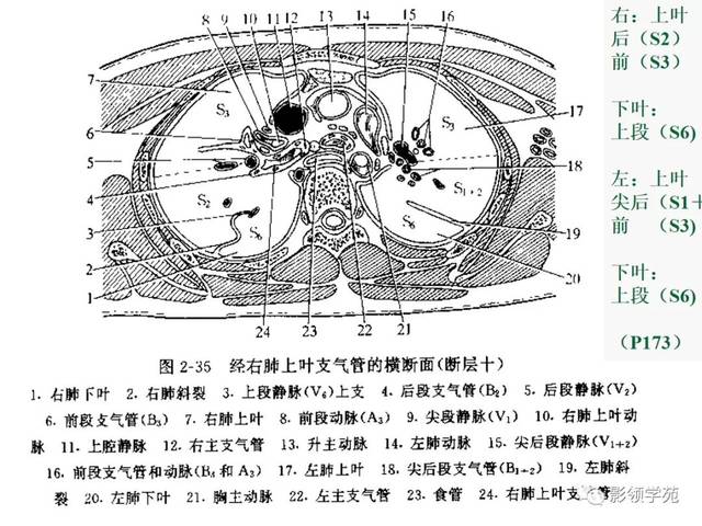 6.左肺上叶动