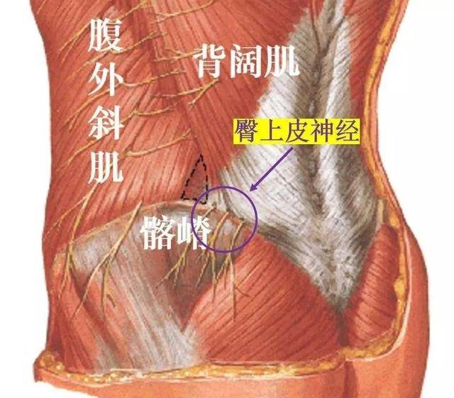 损伤的臀中肌,阔筋膜张肌与髂胫束损伤同是引起大腿外侧痛的主因.