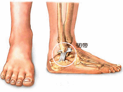 崴脚之后要休息多久才保险?