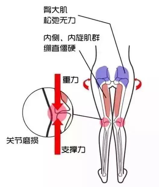 跑步费劲,跑步受伤,可能原因在于你的臀部?