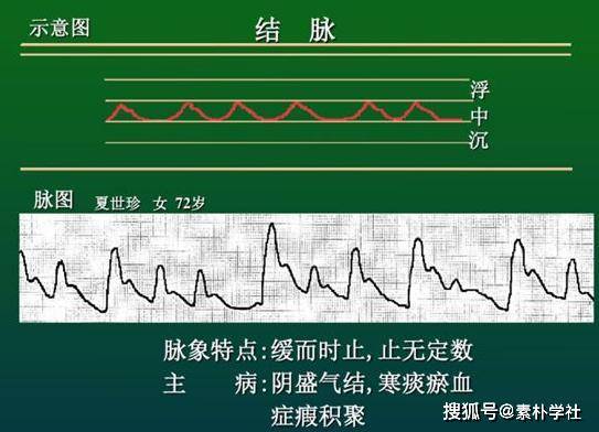 脉诊的核心部分:正常脉象与病理脉象各是什么触感?