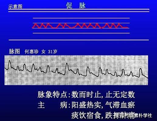 脉诊的核心部分:正常脉象与病理脉象各是什么触感?