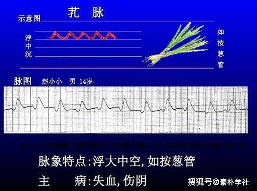 4.革脉