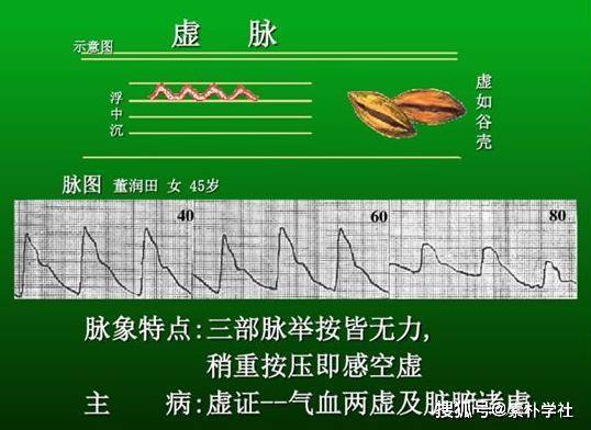 1.虚脉 【脉象特征】三部脉举之无力,按之空虚. 【临床意义】主虚证.