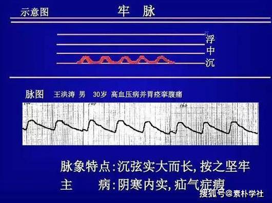 脉诊的核心部分:正常脉象与病理脉象各是什么触感?