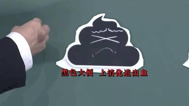 大便"前硬后稀,颜色有黑,有红?切不可大意!