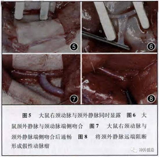 经过一年的反复演练,做了数十只大鼠,几百次的血管吻合训练,可以非常