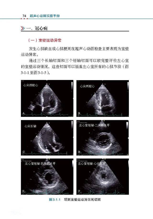 超声心动图实操手册99个超声心动图影像视频带你看图识病
