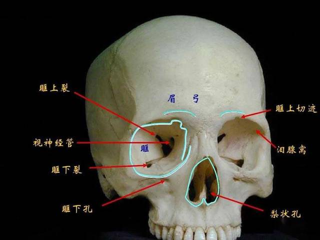 前几天刚讲过,普遍状况下西方女性的眼眶上缘靠近眉弓的位置是凹陷的