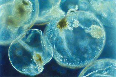 显微镜下的夜光藻丨maria antónia
