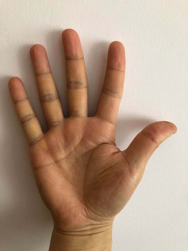 手相分析:日主手掌颜色偏黄基本正常,手掌有肉但较为清瘦,呈现长方形