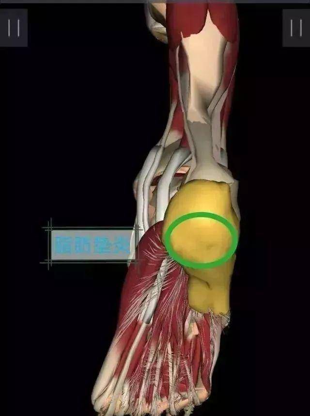 「收藏」11类常见足跟痛的诊疗要点