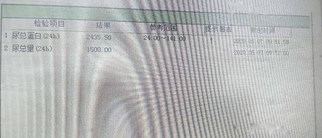 (检查指标) 检查结果为尿毒症晚期 内心充满恐惧与绝望