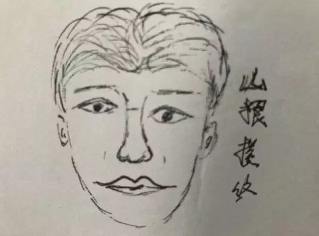 2,山根上出现横纹: 男人山根有横纹,一般指难以继承祖业,多是远离家乡