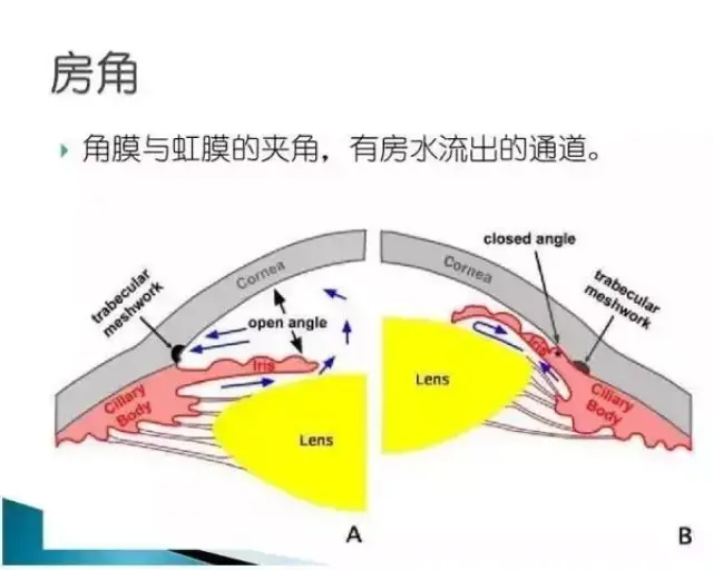 头痛又恶心,快摸摸眼睛是不是比平时硬