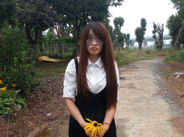 美丽中国救助系列:"黑脸"女孩美丽蝶变
