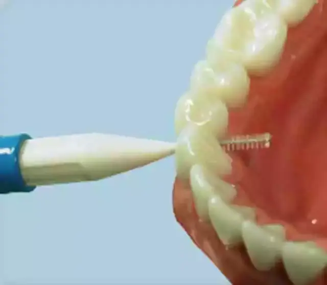 佩戴固定矫治器后由于矫治器的阻碍,刷牙难度增大,这时使用普通牙刷很