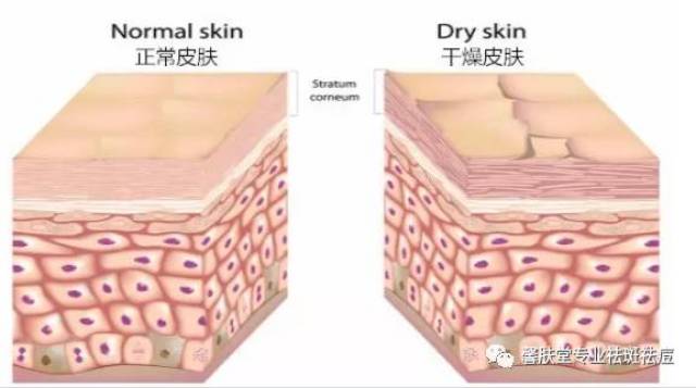 【馨肤堂】干裂的基底层?7月你需要深层补水!