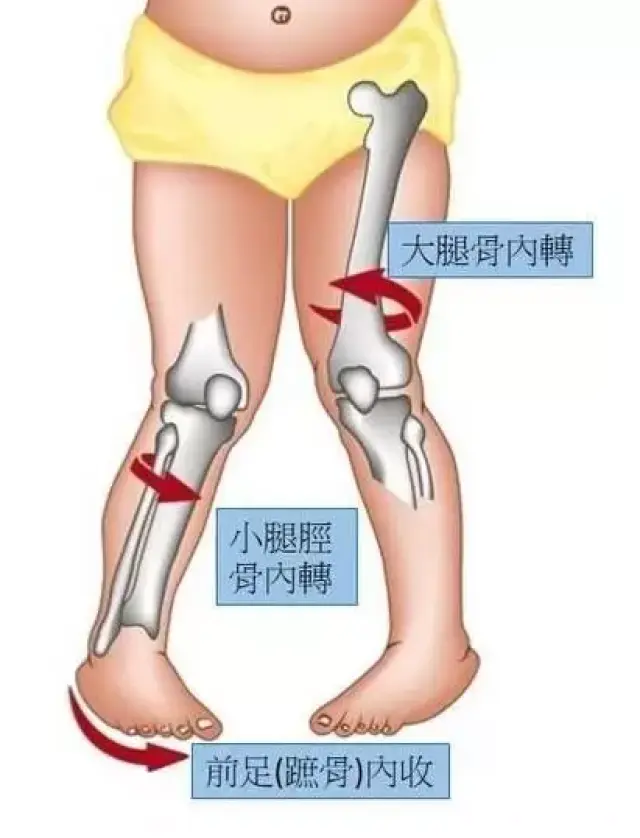 8种错误的走路姿势要你命!每天一小时,得这么走