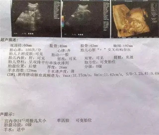 通过双顶径和股骨头的长度来判断.