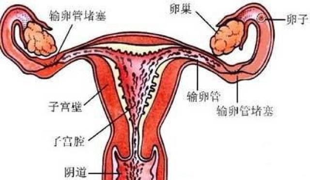 输卵管堵塞,治疗方法大对比!
