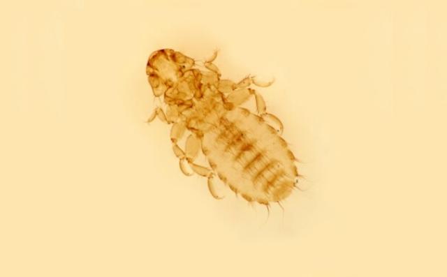 虱什么什么痒的成语_成语口中蚤虱图片(2)