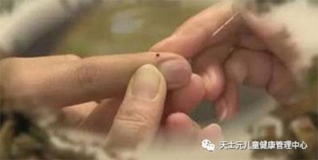 按,揉,掐或针刺 应用: 经常用拇指尖掐一掐商阳,能旺盛大肠经的气血