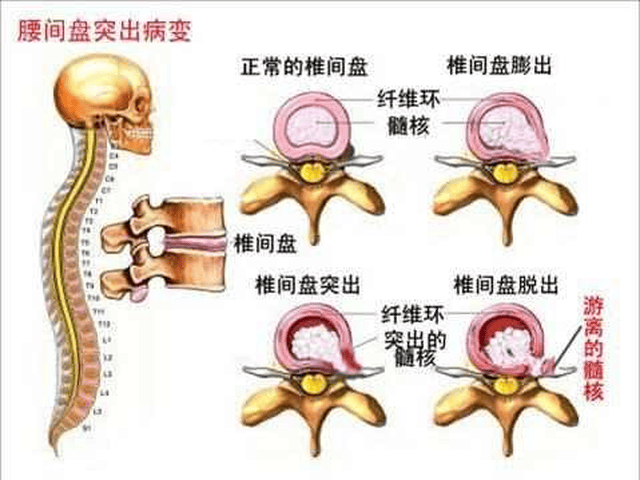 知乎人口老龄化_人口老龄化