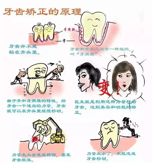 矫正牙齿前,必须要弄明白牙齿矫正的原理和过程!