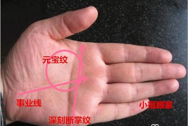 刘先生的手相是标准的断掌纹,而且远远比其他的手纹要深刻清晰得多