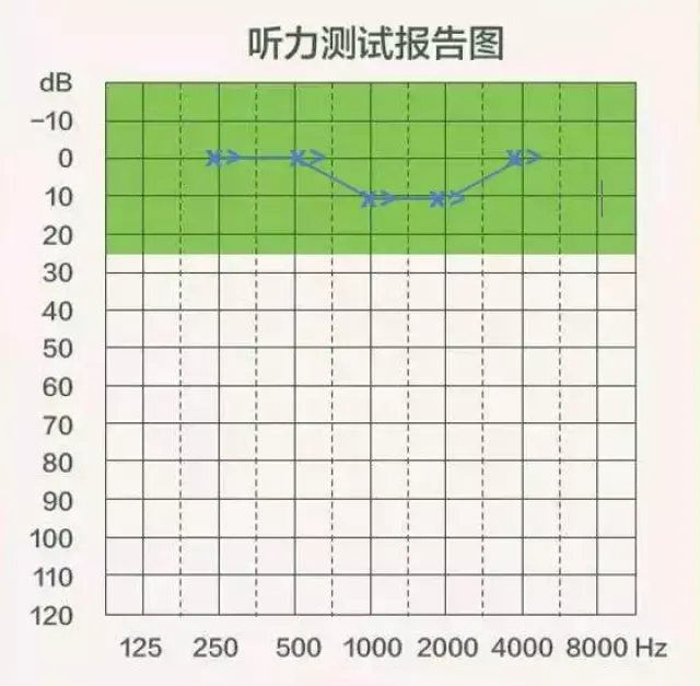 正常听力图